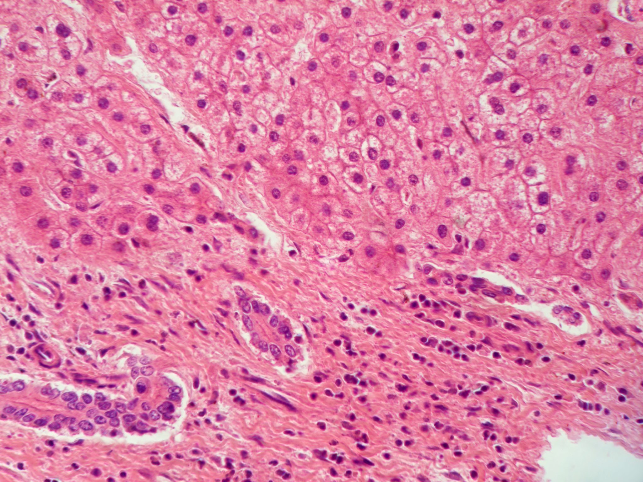 Lifecell Tissue Bioprinting human liver tissue from induced pluripotent stem cells ...