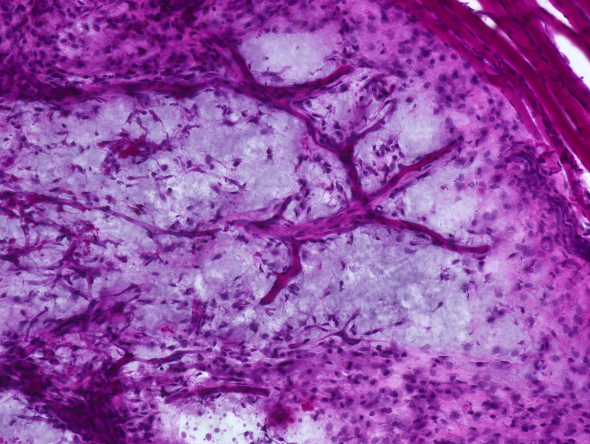 Bioprinting Personalized Medicine - CELLINK