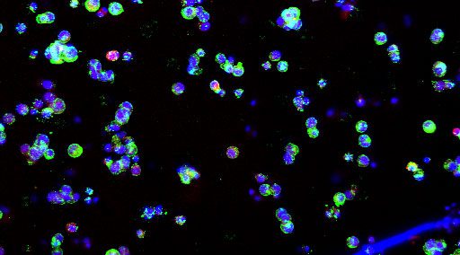 Mimetic liver models with regionally varied stiffness