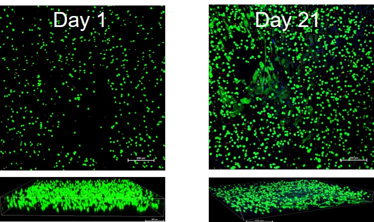 2. Cornea lenticule bioprinted with cells 2. Cornea lenticule bioprinted with cells