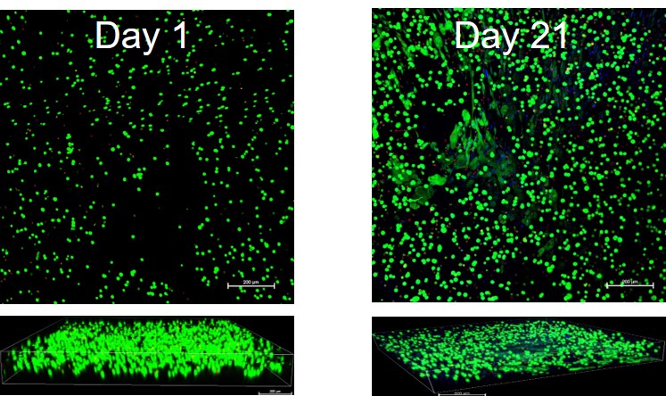 2. Cornea lenticule bioprinted with cells