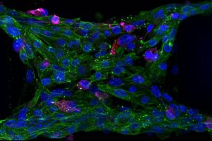 Disease-modeling